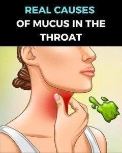 The Real Causes of Constant Phlegm and Mucus in Your Throat 822292326_122171149850960904_8598842340834227858_n