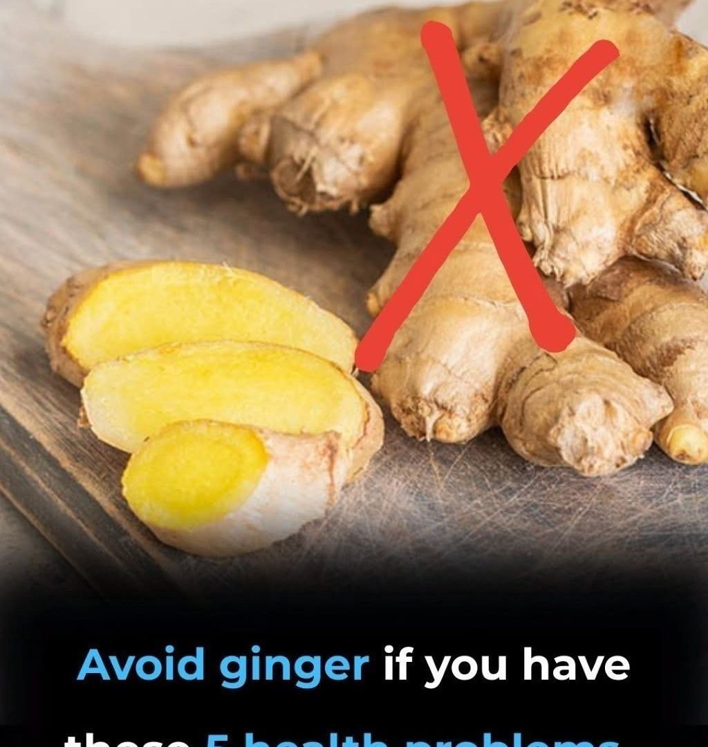 Avoid Ginger If You Have These 5 Health Problems 825292670_122320275062099116_5371900217203199198_n